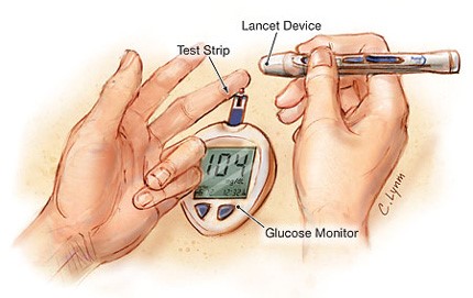 http://www.mojacukrzyca.org/pliki/menu/jama_diabetes_type1.jpg